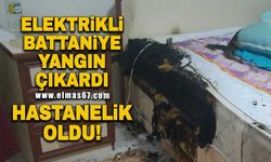 Elektrikli battaniye yangın çıkardı! Hastanelik oldu