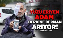 Yüzü eriyen adam derdine derman arıyor!