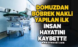 Domuz böbrek nakli yapılan ilk insan hayatını kaybetti!