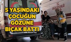 5 yaşındaki çocuğun gözüne oynadığı bıçak battı