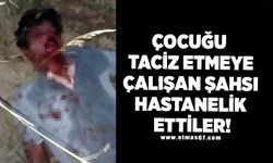 Çocuğu taciz etmeye çalışan şahsı hastanelik ettiler