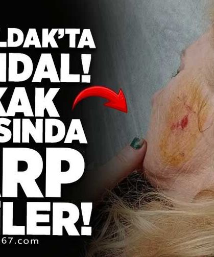 Zonguldak'ta Sokak Ortasında Darp Edilen Kadın Hastaneye Kaldırıldı