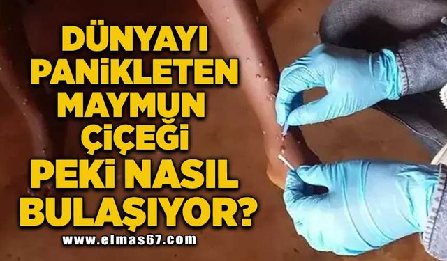 'Derhal adım atılmazsa kontrolden çıkabilir' Alarma geçildi, peki nasıl bulaşıyor?