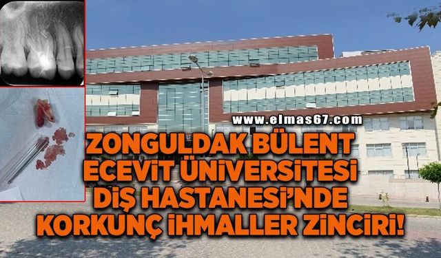 Zonguldak Bülent Ecevit Üniversitesi Diş hastanesinde korkunç ihmaller zinciri!