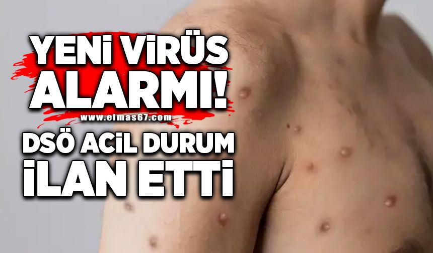 Yeni virüs alarmı! DSÖ acil durumu ilan etti