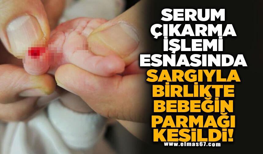 Serum çıkarma işlemi esnasında sargıyla birlikte bebeğin parmağı kesildi