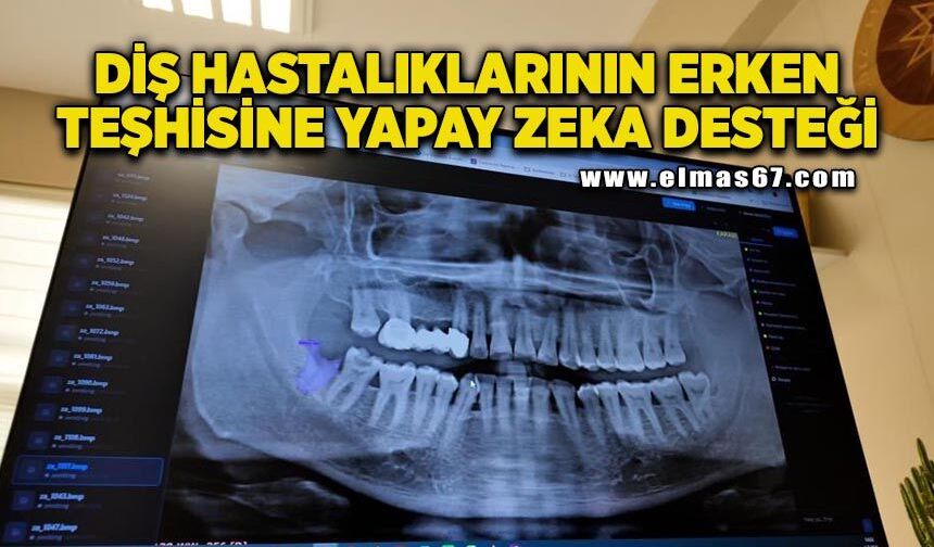 KBÜ'de diş hastalıklarının erken teşhisine yapay zeka desteği